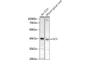 Western blot analysis of extracts of various cell lines, using DCX antibody (ABIN3021509, ABIN3021510, ABIN3021511 and ABIN6215166) at 1:1000 dilution. (Doublecortin 抗体  (AA 11-360))