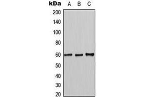 Western blot analysis of MUTYH expression in K562 (A), HL60 (B), NIH3T3 (C) whole cell lysates.