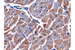 Detection of HIF1a in Human Cardiac Muscle Tissue using Polyclonal Antibody to Hypoxia Inducible Factor 1 Alpha (HIF1a)