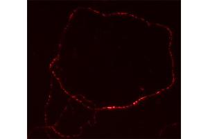 Immunolabeling of cultured hippocampus neurons (dilution 1 : 500). (MAL2 抗体  (AA 13-28))