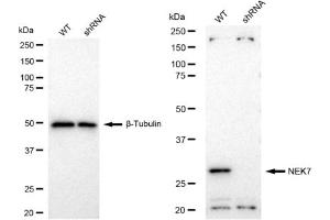 Western blotting analysis using NEK7 antibody (ABIN7799570). (Recombinant NEK7 抗体)
