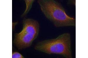 Immunofluorescence staining of methanol-fixed Hela cells using Phospho-PRKCQ-S676 antibody. (PKC theta 抗体  (pSer676))