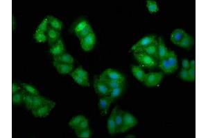 Immunofluorescence staining of HepG2 cells with ABIN7152277 at 1:135, counter-stained with DAPI. (Exopolyphosphatase PRUNE1 (PRUNE1) (AA 1-168) 抗体)