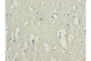 Immunohistochemistry of paraffin-embedded human brain tissue using ABIN7166851 at dilution of 1:100 (RHPN1-AS1 抗体  (AA 1-59))