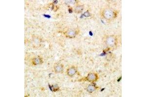 Immunohistochemical analysis of Pumilio 1 staining in mouse brain formalin fixed paraffin embedded tissue section. (PUM1 抗体)