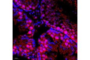Immunofluorescence of paraffin embedded mouse testis using DMRTA2 (ABIN7073753) at dilution of 1: 650 (400x lens) (DMRTA2 抗体)