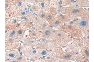 IHC-P analysis of Human Liver Tissue, with DAB staining. (ERBB3 抗体  (AA 709-966))