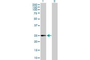 Western Blot analysis of CCBL1 expression in transfected 293T cell line by CCBL1 MaxPab polyclonal antibody. (CCBL1 抗体  (AA 1-250))