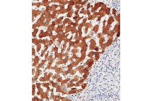 Immunohistochemistry (Paraffin-embedded Sections) (IHC (p)) image for anti-Haptoglobin (HP) (AA 296-322), (Center) antibody (ABIN654637)