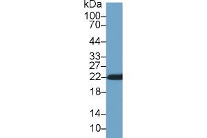 Western Blot; Sample: Rat Skin lysate; Primary Ab: 1µg/ml Rabbit Anti-Rat CYPB Antibody Second Ab: 0. (PPIB 抗体  (AA 34-216))