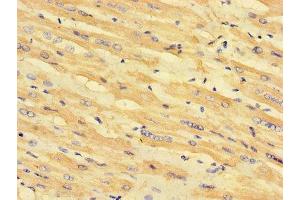 Immunohistochemistry of paraffin-embedded human heart tissue using ABIN7158953 at dilution of 1:100 (MLYCD 抗体  (AA 40-493))