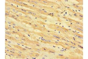 Immunohistochemistry of paraffin-embedded human heart tissue using ABIN7158953 at dilution of 1:100 (MLYCD 抗体  (AA 40-493))