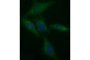 Image no. 2 for anti-Tyrosine Hydroxylase (TH) antibody (ABIN1501369) (Tyrosine Hydroxylase 抗体)