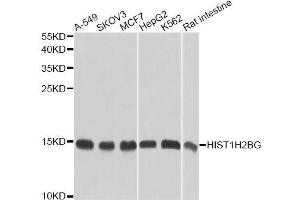 Western blot analysis of extracts of various cell lines, using HIST1H2BG antibody (ABIN6003628) at 1/1000 dilution. (HIST1H2BG 抗体)