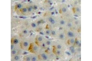 Used in DAB staining on fromalin fixed paraffin-embedded Liver tissue (CD36 抗体  (AA 91-311))