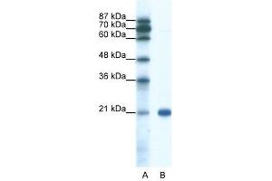 SSX2 antibody used at 0. (SSX2 抗体  (C-Term))
