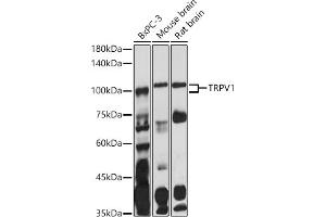 Western blot analysis of extracts of various cell lines, using TRPV1 antibody (ABIN6133947, ABIN6149596, ABIN6149597 and ABIN6224662) at 1:1000 dilution. (TRPV1 抗体  (AA 400-500))