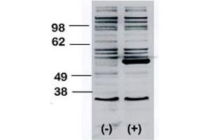 Western blot analysis of BLK polyclonal antibody  transiently transfected HEK293 cell line lysate (1 ug/lane). (BLK 抗体  (N-Term))