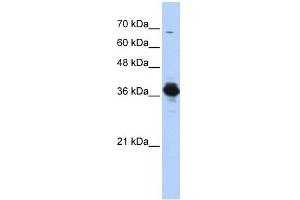 Western Blotting (WB) image for anti-ATPase, H+ Transporting, Lysosomal 38kDa, V0 Subunit D2 (ATP6V0D2) (Middle Region) antibody (ABIN630926)