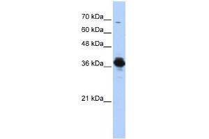ATP6V0D2 antibody used at 1 ug/ml to detect target protein. (ATP6V0D2 抗体  (Middle Region))