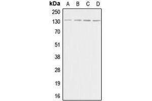 Western blot analysis of Adenylate Cyclase 5/6 expression in HeLa (A), Raw264. (ADCY5/6 抗体  (C-Term))