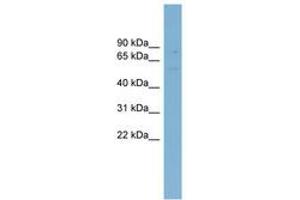 Image no. 1 for anti-ATP-Binding Cassette, Sub-Family G (WHITE), Member 5 (ABCG5) (AA 287-336) antibody (ABIN6744748)