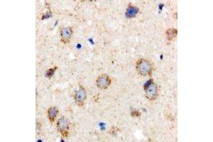 Immunohistochemical analysis of BCS1L staining in rat brain formalin fixed paraffin embedded tissue section. (BCS1L 抗体)