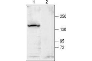 Western blot analysis of rat brain membrane: - 1. (KCNT1 抗体  (C-Term, Intracellular))