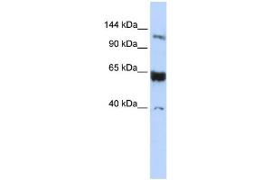 WB Suggested Anti-SYCP1 Antibody Titration: 0. (SYCP1 抗体  (N-Term))