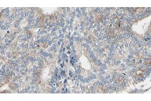 ABIN6277038 at 1/100 staining Human prostate tissue by IHC-P. (ADH5 抗体  (C-Term))
