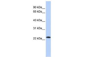 SDF2 antibody used at 1 ug/ml to detect target protein. (SDF2 抗体  (Middle Region))