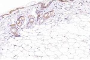Immunohistochemistry analysis of paraffin-embedded mouse skin using,ECRG-2 (ABIN7075552) at dilution of 1: 2600