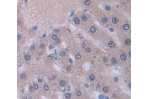 Used in DAB staining on fromalin fixed paraffin- embedded liver tissue (ATP5B 抗体  (AA 47-529))