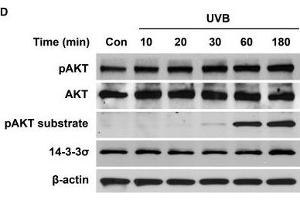 Western Blotting (WB) image for anti-Stratifin (SFN) antibody (ABIN2854867)