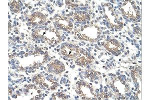Arginase 1 antibody was used for immunohistochemistry at a concentration of 4-8 ug/ml. (Liver Arginase 抗体  (Arg1, N-Term))