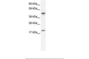 Image no. 1 for anti-Programmed Cell Death 4 (PDCD4) (N-Term) antibody (ABIN6735963) (PDCD4 抗体  (N-Term))