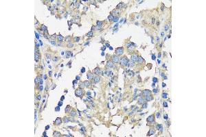 Immunohistochemistry (IHC) image for anti-Ankyrin Repeat, SAM and Basic Leucine Zipper Domain Containing 1 (ASZ1) (AA 1-350) antibody (ABIN7265617)