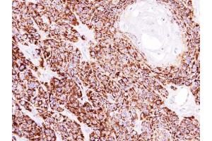 Immunohistochemistry (IHC) image for anti-Cytochrome C Oxidase Subunit IV Isoform 1 (COX4I1) (Center) antibody (ABIN2855069)