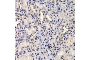 Immunohistochemistry of paraffin-embedded Rat kidney using DDX41 antibody at dilution of 1:100 (x400 lens). (DDX41 抗体)