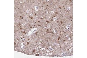 Immunohistochemical staining (Formalin-fixed paraffin-embedded sections) of human cerebral cortex with DCLK2 polyclonal antibody  shows moderate cytoplasmic positivity in neuronal cells at 1:50-1:200 dilution. (DCLK2 抗体)