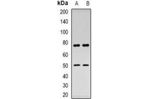 Western blot analysis of Thymopoietin expression in HepG2 (A), mouse kidney (B) whole cell lysates. (Thymopoietin 抗体  (N-Term))