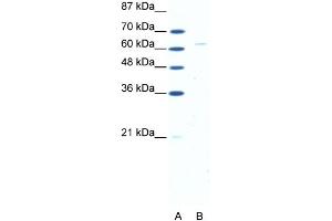 WB Suggested Anti-FOXN1 Antibody Titration: 5. (FOXN1 抗体  (N-Term))
