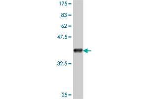 Western Blot detection against Immunogen (37. (CACUL1 抗体  (AA 111-210))