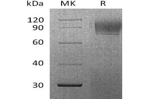 IFNAR1 Protein (His tag)