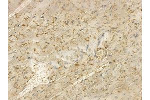 MYLK2 Mouse Monoclonal Antibody at 1/100 staining mouse heart tissue by IHC-P. (MYLK2 抗体  (Internal Region))
