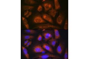 Immunofluorescence (IF) image for anti-Laminin, beta 1 (LAMB1) antibody (ABIN7268185)