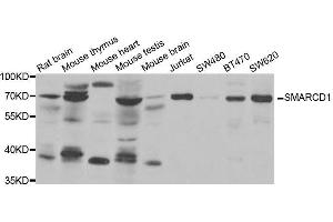 Western blot analysis of extracts of various cell lines, using SMARCD1 antibody. (SMARCD1 抗体  (AA 216-515))