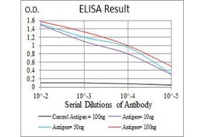 Black line: Control Antigen (100 ng), Purple line: Antigen(10 ng), Blue line: Antigen (50 ng), Red line: Antigen (100 ng), (LDLR 抗体  (AA 22-150))