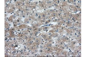 Immunohistochemical staining of paraffin-embedded Human liver tissue using anti-C9orf41 mouse monoclonal antibody. (C9orf41 抗体)