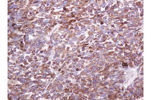 Image no. 1 for anti-Mucin 1 (MUC1) antibody (ABIN1499598) (MUC1 抗体)